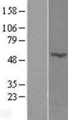Western Blot: POFUT2 Overexpression Lysate (Adult Normal) [NBL1-14565] Left-Empty vector transfected control cell lysate (HEK293 cell lysate); Right -Over-expression Lysate for POFUT2.