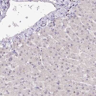 Immunohistochemistry-Paraffin POLA2 Antibody