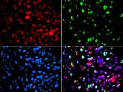 Immunocytochemistry/Immunofluorescence: POLD3 Antibody [NBP2-93032] - Analysis of GFP-RNF168 transgenic U2OS cells using POLD3 can be used to mark cells damaged by UV-A laser for they always gather around DNA damage region.