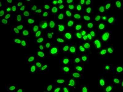 Immunocytochemistry/Immunofluorescence: POLD3 Antibody [NBP2-93032] - Analysis of U2OS cells using POLD3 .