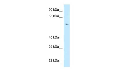 Western Blot: POLD3 Antibody [NBP2-85512] - WB Suggested Anti-POLD3 Antibody. Titration: 1.0 ug/ml. Positive Control: Jurkat Whole CellPOLD3 is supported by BioGPS gene expression data to be expressed in Jurkat