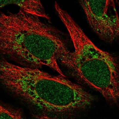 Immunocytochemistry/ Immunofluorescence POLD4 Antibody