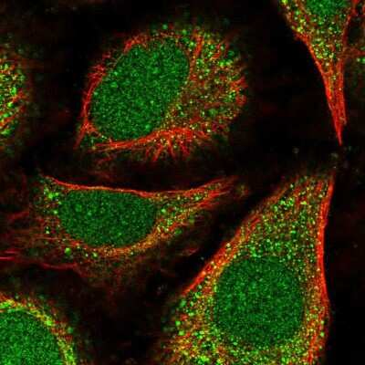 Immunocytochemistry/ Immunofluorescence POLE4 Antibody