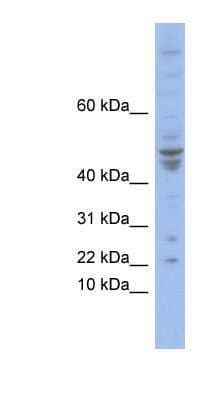 Western Blot POLE4 Antibody