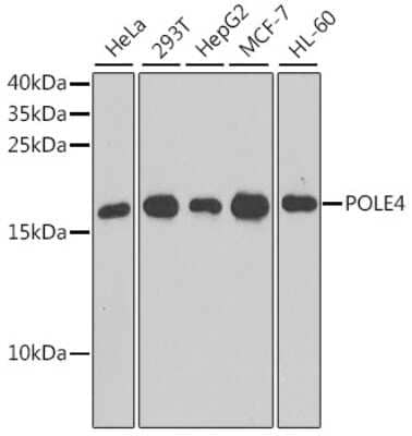 Western Blot: POLE4 Antibody [NBP2-93562] - Analysis of extracts of various cell lines, using POLE4 at 1:1000 dilution. Secondary antibody: HRP Goat Anti-Rabbit IgG (H+L) at 1:10000 dilution. Lysates/proteins: 25ug per lane. Blocking buffer: 3% nonfat dry milk in TBST. Detection: ECL Basic Kit . Exposure time: 90s.