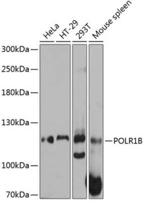 Western Blot: POLR1B Antibody [NBP2-93757] - Analysis of extracts of various cell lines, using POLR1B at 1:3000 dilution. Secondary antibody: HRP Goat Anti-Rabbit IgG (H+L) at 1:10000 dilution. Lysates/proteins: 25ug per lane. Blocking buffer: 3% nonfat dry milk in TBST. Detection: ECL Basic Kit . Exposure time: 10s.