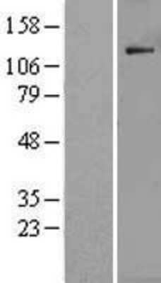 Western Blot POLR1B Overexpression Lysate