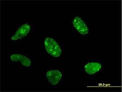 Immunocytochemistry/Immunofluorescence: POLR1C Antibody (2A5-A5) [H00009533-M02] - Analysis of monoclonal antibody to POLR1C on HeLa cell . Antibody concentration 10 ug/ml.