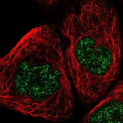 Immunocytochemistry/Immunofluorescence: POLR1C Antibody [NBP1-87114] - Staining of human cell line A-431 shows positivity in nucleus but not nucleoli. Antibody staining is shown in green.