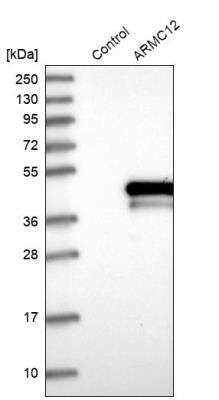 Western Blot: POLR1C Antibody [NBP1-87114] - Analysis in control (vector only transfected HEK293T lysate) and POLR1C over-expression lysate (Co-expressed with a C-terminal myc-DDK tag (~3.1 kDa) in mammalian HEK293T cells).