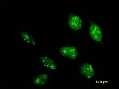 Immunocytochemistry/Immunofluorescence: POLR1D Antibody [H00051082-B01P] - Analysis of purified antibody to POLR1D on HeLa cell. (antibody concentration 10 ug/ml)