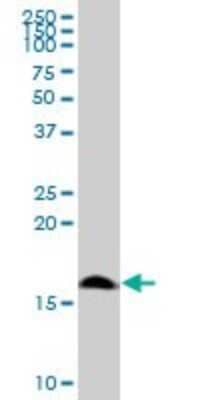 Western Blot: POLR1D Antibody [H00051082-B01P] - Analysis of POLR1D expression in Jurkat.