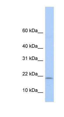 Western Blot: POLR1D Antibody [NBP1-52917] - Human Lung lysate, concentration 0.2-1 ug/ml.