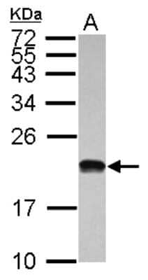 Western Blot: POLR1D Antibody [NBP2-19884] - Sample (30 ug of whole cell lysate) A: Hep G2 15% SDS PAGE gel, diluted at 1:1000.