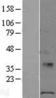 Western Blot POLR1D Overexpression Lysate