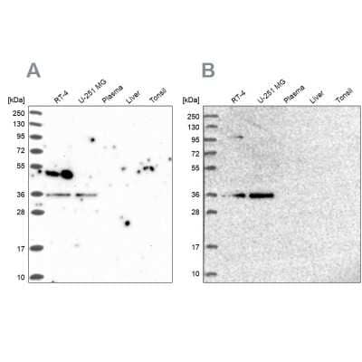 Western Blot: POLR2C Antibody [NBP1-80817] - Analysis using Anti-POLR2C antibody NBP1-80817 (A) shows similar pattern to independent antibody NBP1-80818 (B).