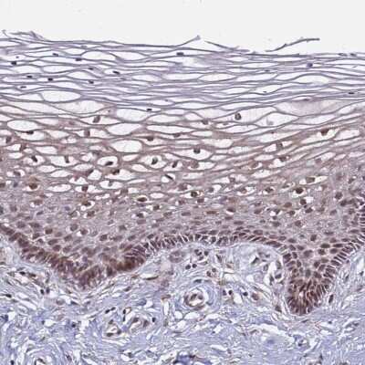 Immunohistochemistry-Paraffin: POLR2D Antibody [NBP1-92280] - Staining of human cervix, uterine shows nuclear positivity in squamous epithelial cells.