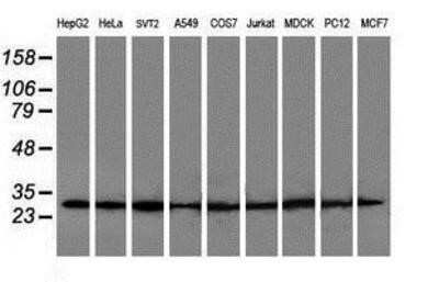 Western Blot: POLR2E Antibody (OTI3B5) [NBP2-00482] - Analysis of extracts (35ug) from 9 different cell lines by using anti-POLR2E monoclonal antibody.