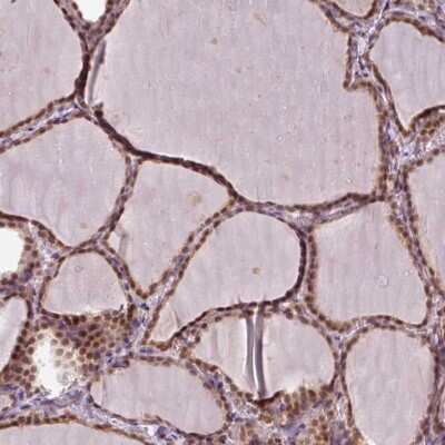 Immunohistochemistry-Paraffin: POLR2G Antibody [NBP2-47329] - Staining of human thyroid gland shows moderate nuclear positivity in glandular cells.