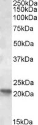 Western Blot: POLR2G Antibody [NBP1-37777] - Analysis of POLR2G in Human Brain (Cerebellum) lysates (calculated MW of 19.3kDa according to NP_002687.1) using NBP1-37777 at 1-3ug/ml.