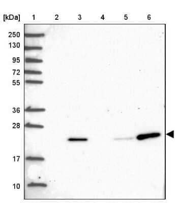 Western Blot: POLR2G Antibody [NBP2-47329] - Lane 1: Marker  [kDa] 250, 130, 95, 72, 55, 36, 28, 17, 10.  Lane 2: Human cell line RT-4.  Lane 3: Human cell line U-251MG.  Lane 4: Human plasma (IgG/HSA depleted).  Lane 5: Human liver tissue.  Lane 6: Human tonsil tissue.