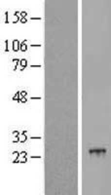 Western Blot: POLR2G Overexpression Lysate (Adult Normal) [NBL1-14584] Left-Empty vector transfected control cell lysate (HEK293 cell lysate); Right -Over-expression Lysate for POLR2G.