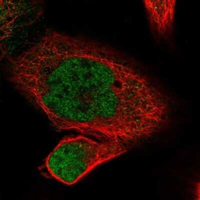 Immunocytochemistry/Immunofluorescence: POLR2J Antibody [NBP2-46733] - Staining of human cell line A-431 shows localization to nucleoplasm.