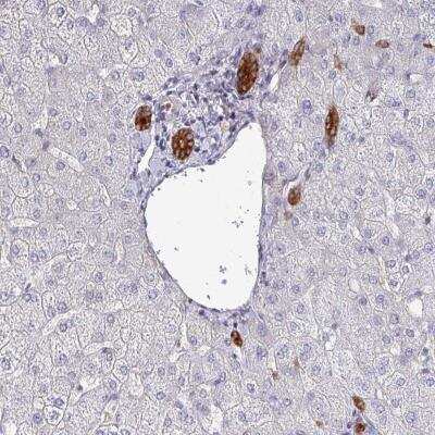 Immunohistochemistry: POLR2J Antibody [NBP2-46697] - Staining of human liver shows strong cytoplasmic positivity in bile duct cells.