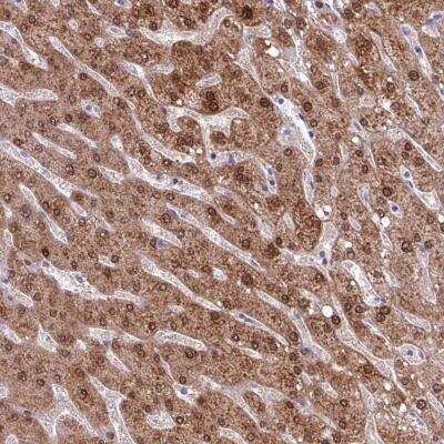 Immunohistochemistry: POLR2J Antibody [NBP2-46733] - Staining of human liver tissue.