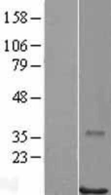 Western Blot: POLR2J Overexpression Lysate (Adult Normal) [NBL1-14586] Left-Empty vector transfected control cell lysate (HEK293 cell lysate); Right -Over-expression Lysate for POLR2J.