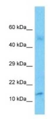 Western Blot POLR2J3 Antibody