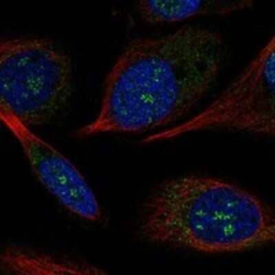 Immunocytochemistry/Immunofluorescence: POLR2K Antibody [NBP3-17417] - Staining of human cell line PC-3 shows localization to nucleoli fibrillar center.