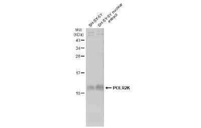 Western Blot: POLR2K Antibody [NBP3-13147] - SH-SY5Y whole cell and nuclear extracts (30 ug) were separated by 15% SDS-PAGE, and the membrane was blotted with POLR2K antibody (NBP3-13147) diluted at 1:1000. The HRP-conjugated anti-rabbit IgG antibody (NBP2-19301) was used to detect the primary antibody, and the signal was developed with Trident ECL plus-Enhanced.