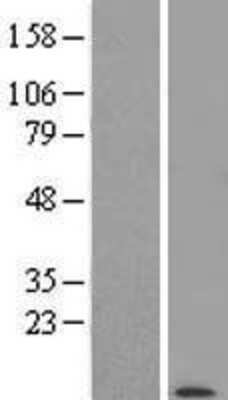 Western Blot POLR2K Overexpression Lysate