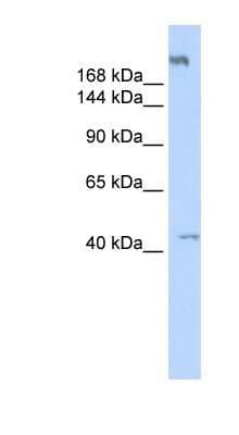 Western Blot: POLR3A Antibody [NBP1-53051] - Human Muscle lysate. Recommended antibody concentration: 0.2 - 1 ug/mL.