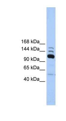 Western Blot: POLR3B Antibody [NBP1-54363] - Human Heart lysate, concentration 0.2-1 ug/ml.