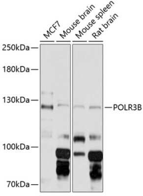 Western Blot: POLR3B Antibody [NBP2-93137] - Analysis of extracts of various cell lines, using POLR3B at 1:3000 dilution. Secondary antibody: HRP Goat Anti-Rabbit IgG (H+L) at 1:10000 dilution. Lysates/proteins: 25ug per lane. Blocking buffer: 3% nonfat dry milk in TBST. Detection: ECL Basic Kit . Exposure time: 5s.