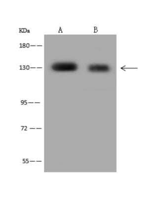 Western Blot: POLR3B Antibody [NBP3-06317] - Anti-POLR3B rabbit polyclonal antibody at 1:500 dilutionLane A: HeLa Whole Cell LysateLane B: 293T Whole Cell LysateLysates/proteins at 30 ug per lane.SecondaryGoat Anti-Rabbit IgG (H+L) HRP at 110000 dilution.Developed using the ECL technique.Performed under reducing conditions.Predicted band size:128 kDaObserved band size:130 kDa