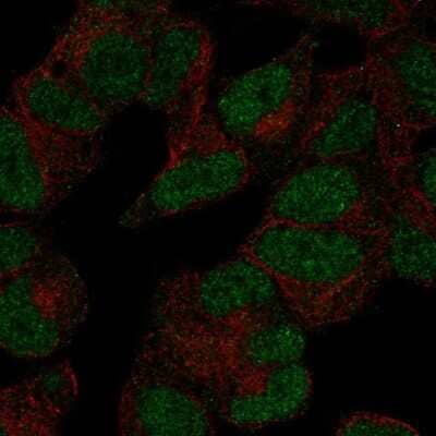 Immunocytochemistry/Immunofluorescence: POLR3D Antibody [NBP2-55887] - Staining of human cell line SH-SY5Y shows localization to nucleoplasm.