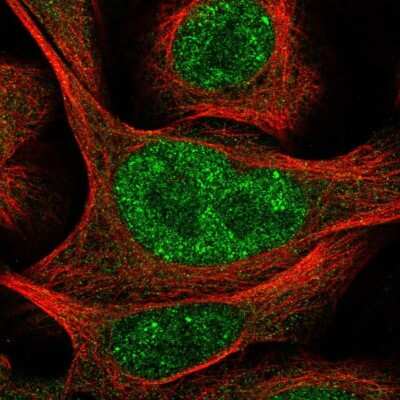 Immunocytochemistry/Immunofluorescence: POLR3D Antibody [NBP2-56240] - Staining of human cell line U-2 OS shows localization to nucleoplasm & cytosol.