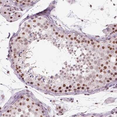 Immunohistochemistry: POLR3D Antibody [NBP2-49556] - Staining of human testis shows moderate nuclear positivity in cells in seminiferous ducts.