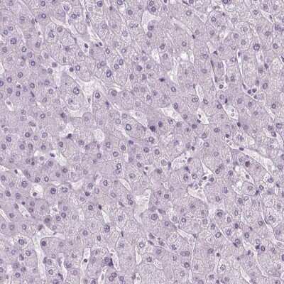 Immunohistochemistry-Paraffin: POLR3D Antibody [NBP2-49556] - Staining of human liver shows low expression as expected.