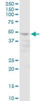 Western Blot: POLR3D Antibody [H00000661-B01P] - Analysis of POLR3D expression in HeLa.