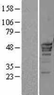 Western Blot POLR3D Overexpression Lysate