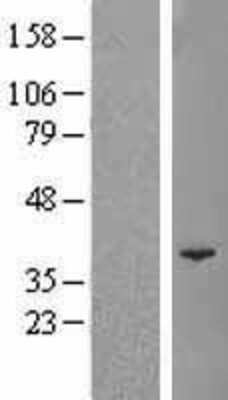 Western Blot: POLR3F Overexpression Lysate (Adult Normal) [NBL1-14593] Left-Empty vector transfected control cell lysate (HEK293 cell lysate); Right -Over-expression Lysate for POLR3F.