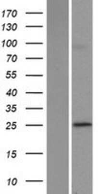 Western Blot: POLR3G Overexpression Lysate (Adult Normal) [NBP2-07616] Left-Empty vector transfected control cell lysate (HEK293 cell lysate); Right -Over-expression Lysate for POLR3G.