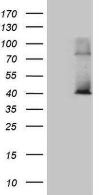 Western Blot: POLR3H Antibody (OTI5A12) [NBP2-45368] - HEK293T cells were transfected with the pCMV6-ENTRY control (Left lane) or pCMV6-ENTRY POLR3H (Right lane) cDNA for 48 hrs and lysed. Equivalent amounts of cell lysates (5 ug per lane) were separated by SDS-PAGE and immunoblotted with anti-POLR3. 