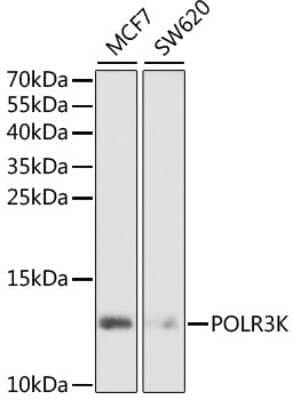 Western Blot: POLR3K Antibody [NBP2-94027] - Analysis of extracts of various cell lines, using POLR3K at 1:1000 dilution. Secondary antibody: HRP Goat Anti-Rabbit IgG (H+L) at 1:10000 dilution. Lysates/proteins: 25ug per lane. Blocking buffer: 3% nonfat dry milk in TBST. Detection: ECL Basic Kit . Exposure time: 90s.