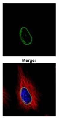 Immunocytochemistry/Immunofluorescence: POM121 Antibody [NBP2-19890] - Confocal immunofluorescence analysis of methanol-fixed HeLa, using POM121 antibody (Green) at 1:500 dilution. Alpha-tubulin filaments are labeled with Alpha-tubulin antibody (Red) at 1:500.