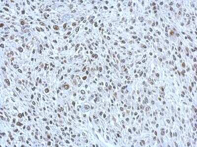 Immunohistochemistry-Paraffin: POM121 Antibody [NBP2-19890] - Immunohistochemical analysis of paraffin-embedded C2C12 xenograft, using antibody at 1:500 dilution.